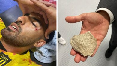 Photo of La dura queja del jugador de Peñarol Maxi Olivera agredido con un proyectil en su rostro ante Rosario Central: “¡Una vergüenza!”